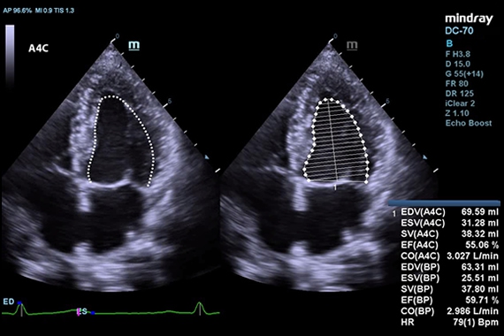 Mindray DC-70 pro X-Insight