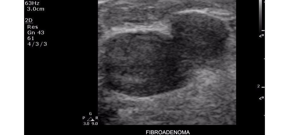 Philips ClearVue 350