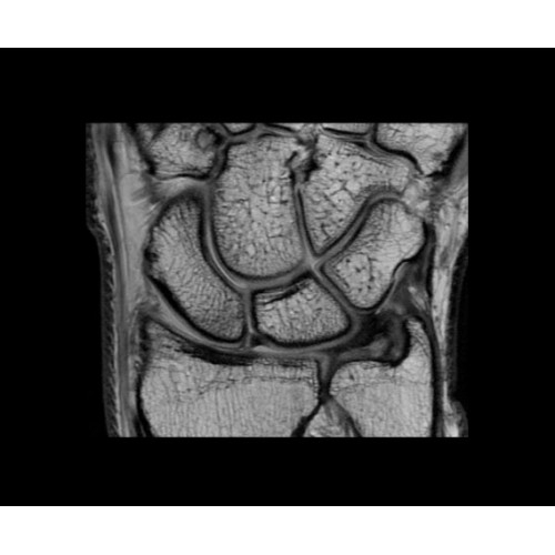 МРТ аппарат GE SIGNA Architect 3.0T