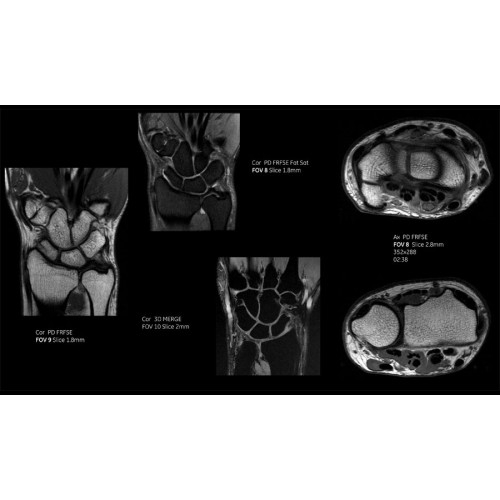 МРТ аппарат GE SIGNA Pioneer 3.0T