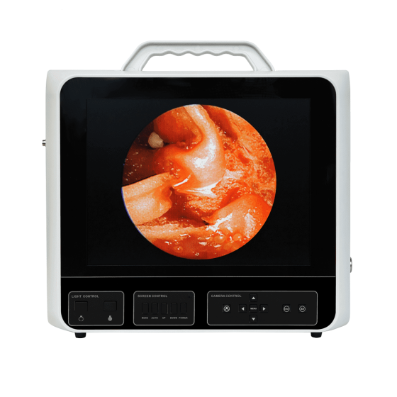 Видеоэндоскопическая система DS.Vision SD 3in1