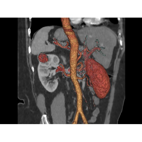 КТ аппарат GE Optima CT520